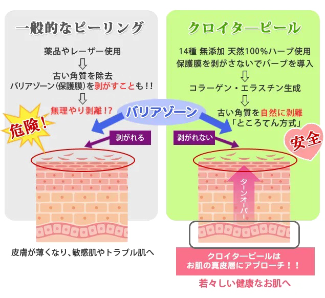 クロイターピール