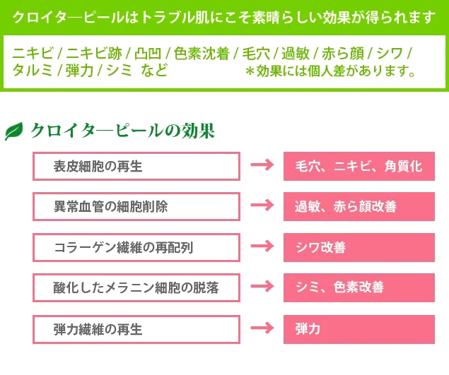 クロイターピール